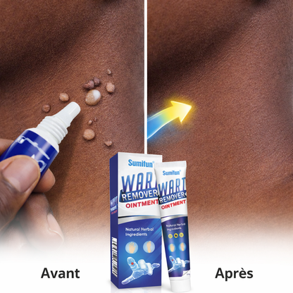 Crème anti verrues